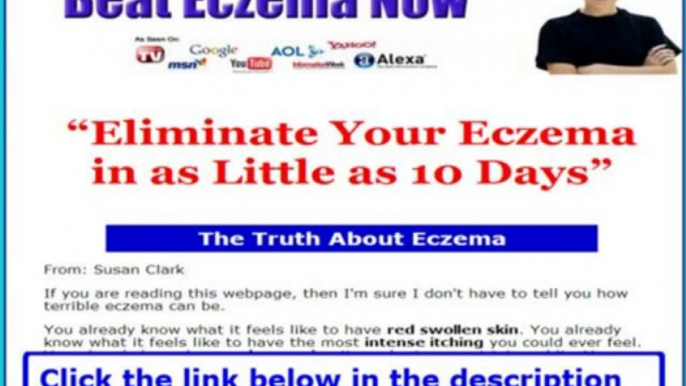 Beat Eczema Now Review + How To Beat Eczema