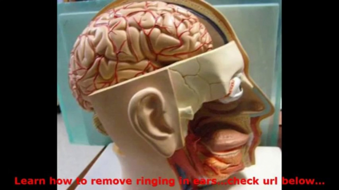 tinnitus miracle scam Discover secret methods to remove ringing in ears tinnitus miracle scam