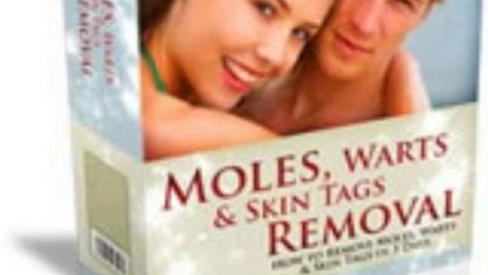 Moles, Warts & Skin Tags Removal Review + Bonus