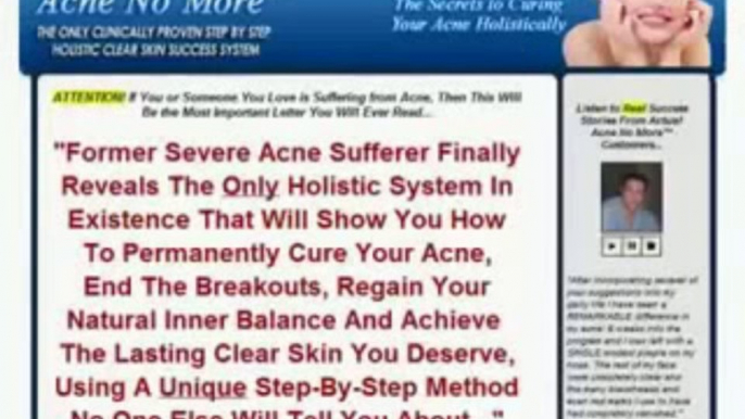 How To Get Rid Of Acne | Acne No More | How To Get Rid Of Pimples | how to control acne