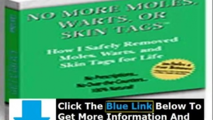 Moles Warts & Skin Tags Removal Charles Davidson + Charles Davidson Moles Warts Skin Tags Removal Review