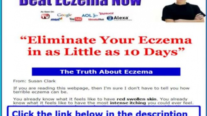 Beat Eczema By Susan Clark + Beat Eczema Cream