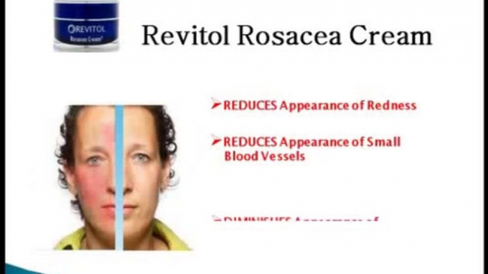 How and Where You Can Get Revitol Rosacea Cream for Free