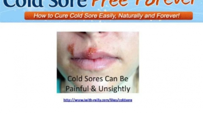 Best Cold Sore Treatment - How To Get Rid Of Cold Sores Fast