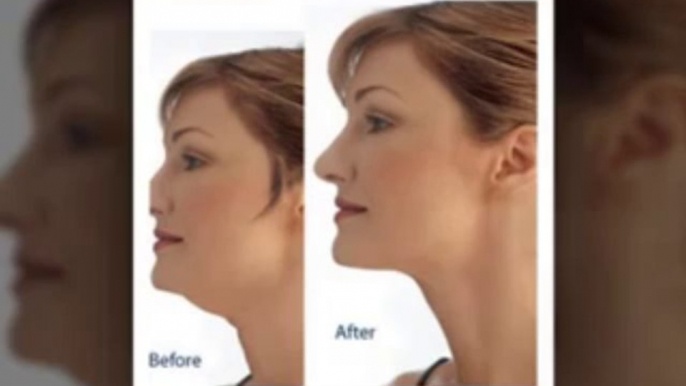 How to lose fat face - Get rid of Chubby Cheeks and Double Chin