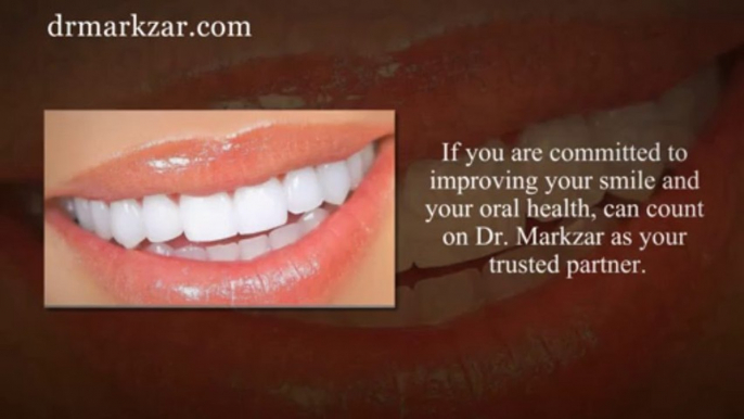 Complete Preventive Patient Care By Beverly Hills Periodontal Arts & Implants