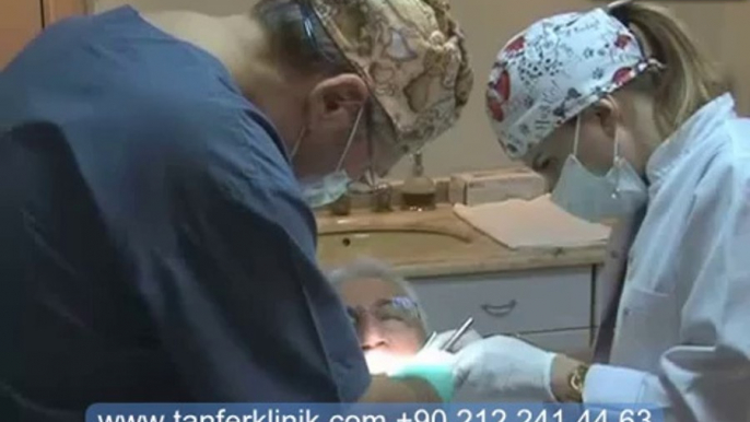 Tanfer Klinik - Diş implantı taktırmanın avantajları nelerdir