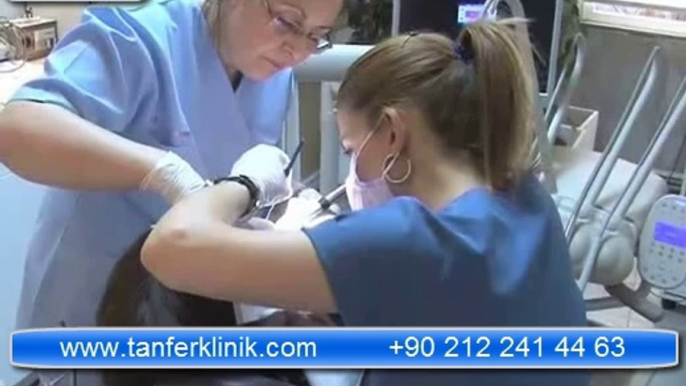 Tanfer Klinik - Diş taşlarını temizletmek dişlere zarar verir mi