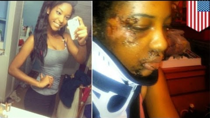 Aspiring model brutally beaten documents recovery on Instagram