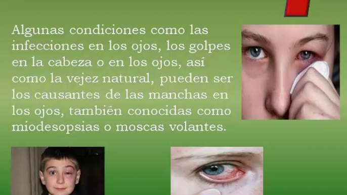 Como Quitar Las Manchas en los Ojos: Como Se Pueden Quitar Las Manchas en los Ojos