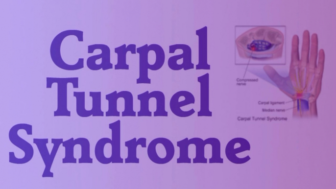 Carpal Tunnel Syndrome-If you are experiencing pain in your wrist, or tingling or a.  tingling sensation in your fingers, it’s quite feasible you have.  carpal tunnel disorder. With any luck, the details in this.  short article will certainly assist you