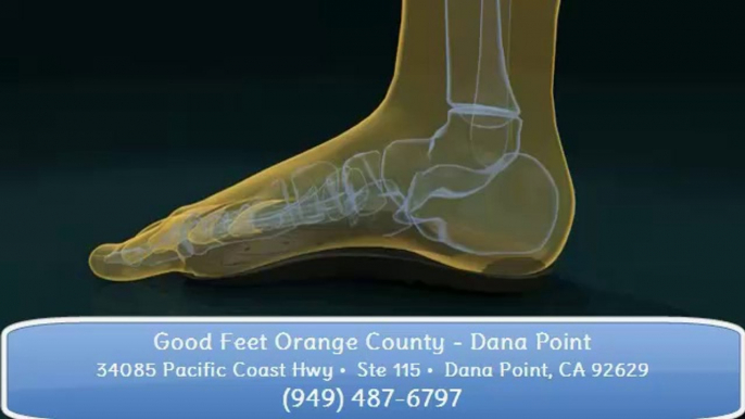 Good Feet Orange County Customers discover Arch Pain Relief from Plantar Fasciitis