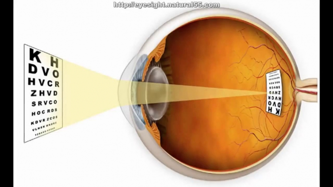 How To Improve Your Vision Without Wearing Glasses  Bates Method For Vision Improvement