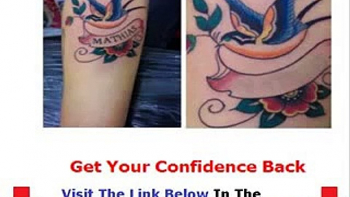 The Get Rid Tattoo Real Get Rid Tattoo Bonus + Discount