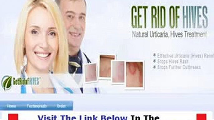 Get Rid Of Hives Honest Review Bonus + Discount