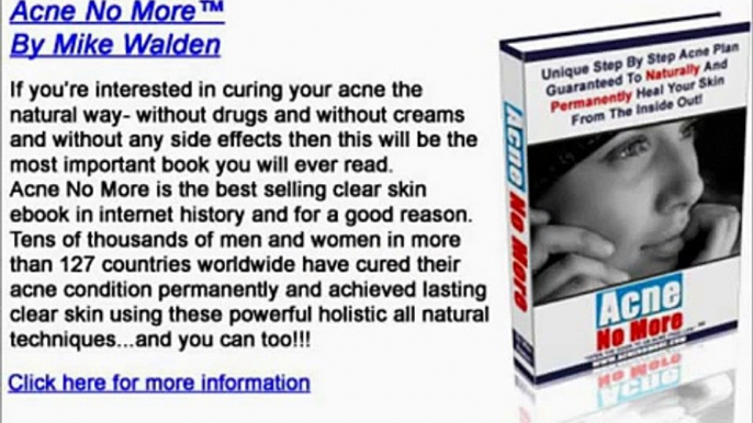 Acne No More   The Things You Should Never Do To Your skin When You Have Acne   YouTube