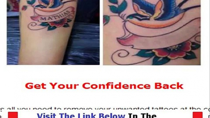 Get Rid Tattoo Naturally Reviews Bonus + Discount