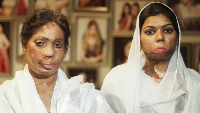 Acid Attack Survivors: Beauty Salon Owner Helps Rehabilitate Victims