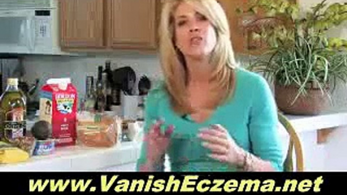 Natural Remedies For Eczema - Tips on How to Beat Eczema the Natural Way