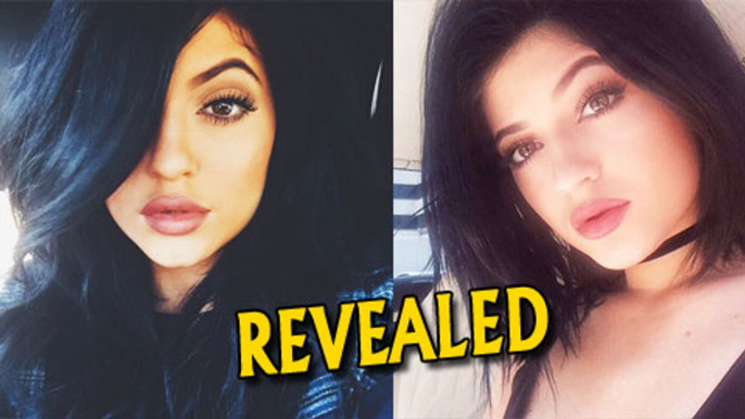 REVEALED: Kylie Jenner Lip Confession | Admits To Lip Injections