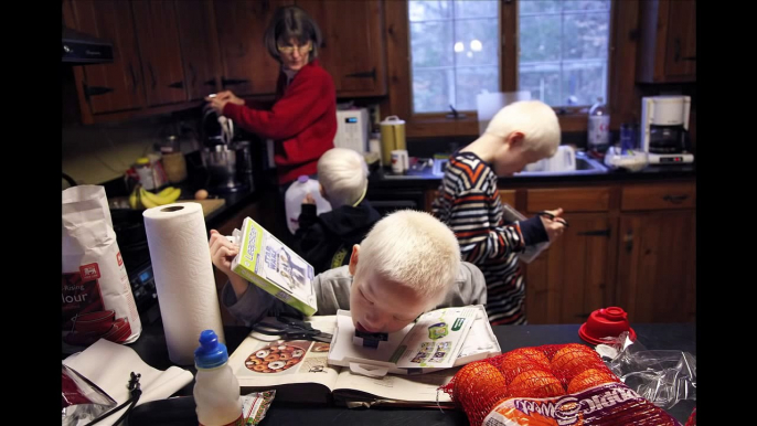 Chosen Ones - Couple adopts Chinese boys with albinism
