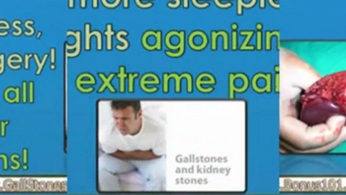 gallstone removal - gallstone treatment - gallstones removal