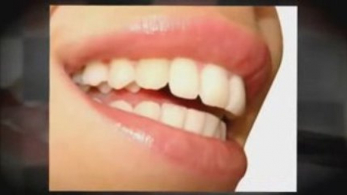 Professional Whitening Kits I Teeth Whitener