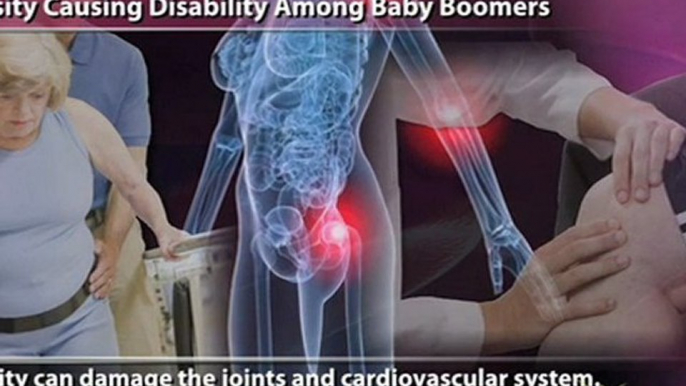 Obesity Causing Disability Among Baby Boomers