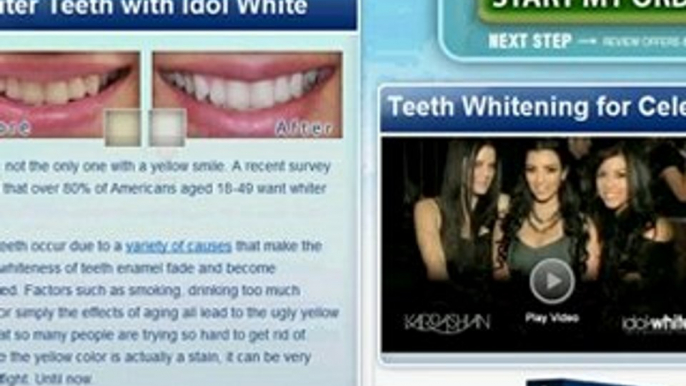 Cheap, Fast Teeth Whitener-Alternative to Opalescence ...