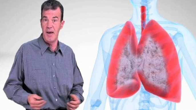 Mesothelioma Information, Facts - Los Angeles, California