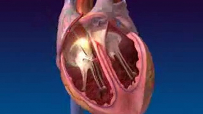 Argosy Medical Animation Sectioned Heart