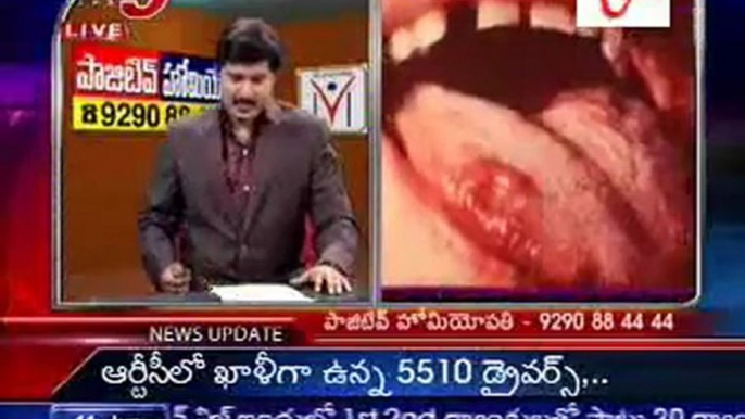 Health File - Sexually Transmitted Diseases(STD) problems  - Dr. Chandrashekar - 01