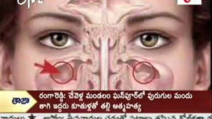 Sinusitis Issues-Problems-Health Tips