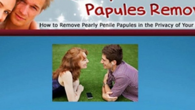 papules treatment - penile papules removal