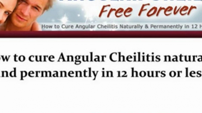 angular cheilitis treatment - angular cheilitis