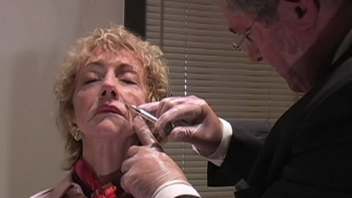 Facial Fillers Phoenix - Juvederm® Demonstration