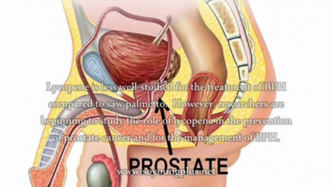 Naturopathic Treatment For Prostate Enlargement - What's The Best Naturopathic Treatment For Prostate?