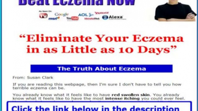 Beat Eczema Download + Beat Eczema Now Reviews