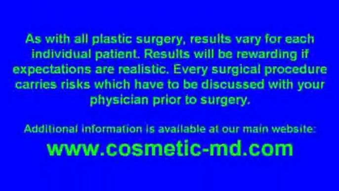 Dr Blau - Gynecomastia Surgery cost- Severe - Male Breast Reduction  - Male Breast Treatment Cost