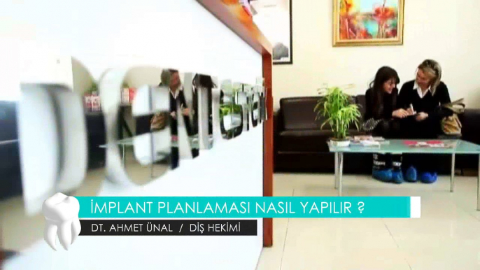 DT. AHMET ÜNAL / DİŞ HEKİMİ - İMPLANT PLANLAMASI NASIL YAPILIR ?