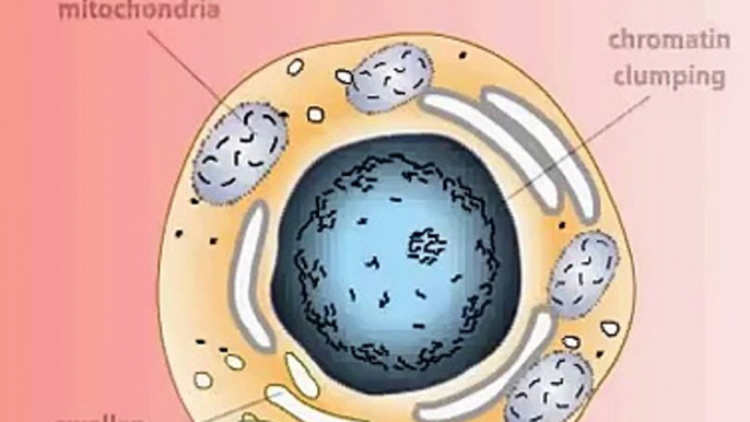 Cell death Necrosis and Apoptosis