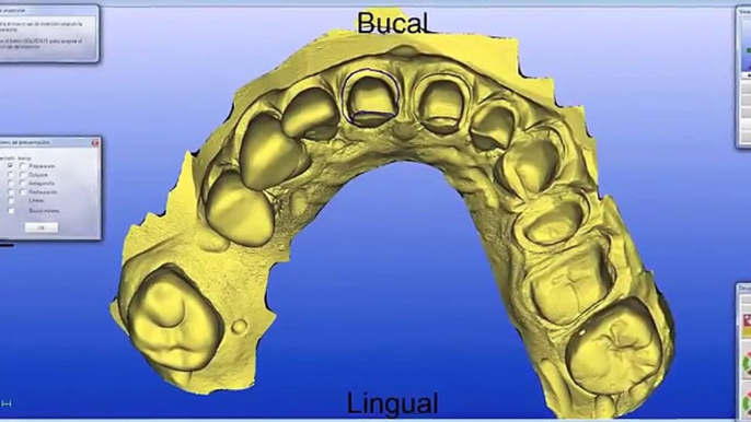 Cad Cam  Technology Costa Rica ,Dentistry Costa Rica  Tours Costa Rica.