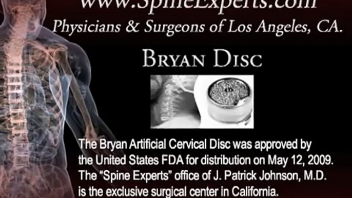 Bryan Artifical Cervical Disc * Replaces diseased or bulging cervical disc causing neck or arm pain