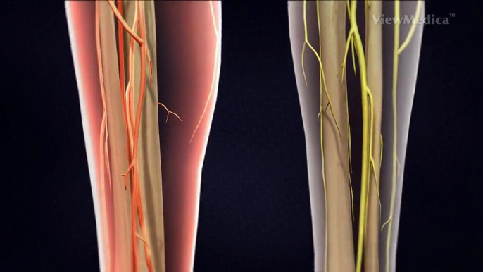 Lumbar Transforaminal Epidural Steroid Injection | Kypainassociates