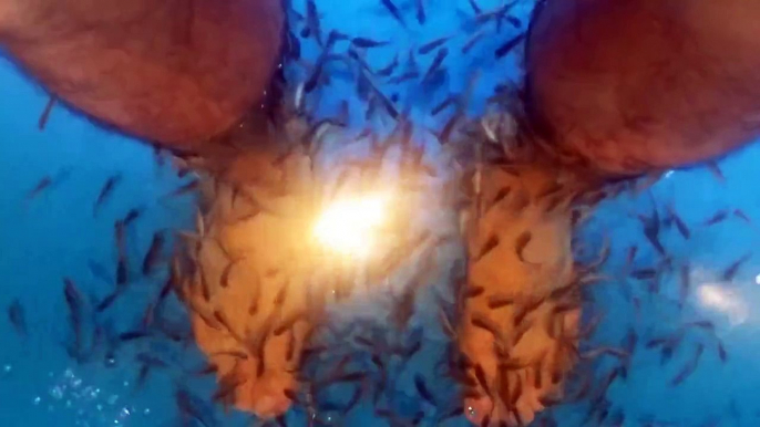 Fish eat dead skin off spa-goers feet