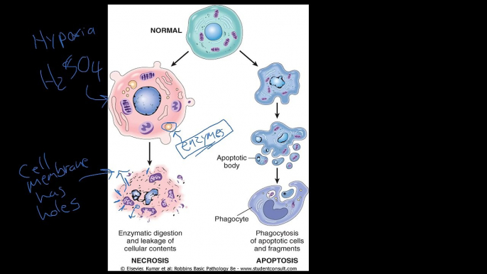 #4 - Introduction to Pathology - Necrosis vs. Apoptosis