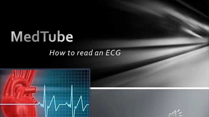 How to read an ECG easily