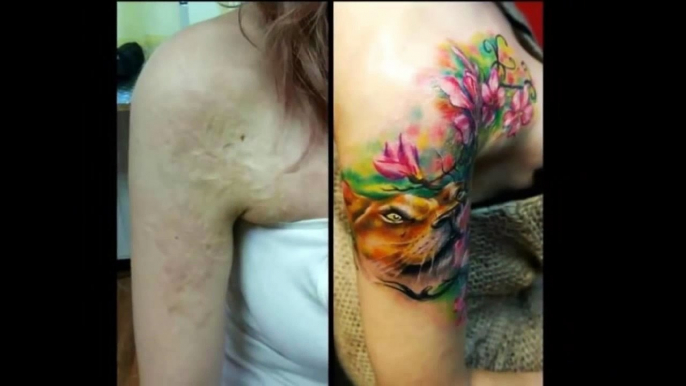 Amazing Scar-Covering Tattoos - Epic Cover Up