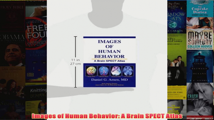 Images of Human Behavior A Brain SPECT Atlas