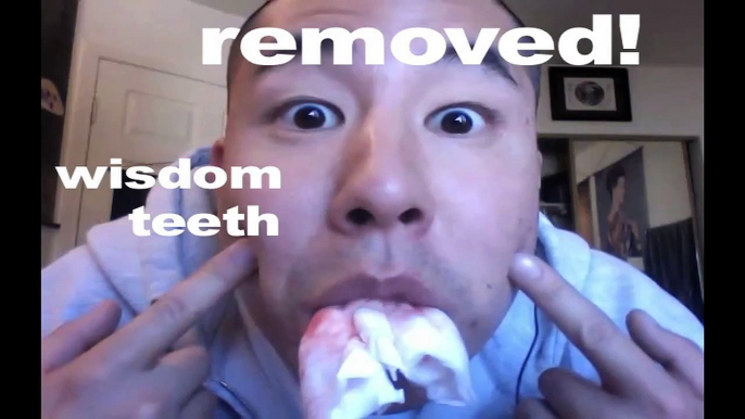 wisdom teeth removed for toothless pimps